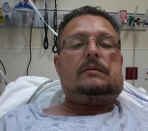 Eliel Perez driver shot in face recovering